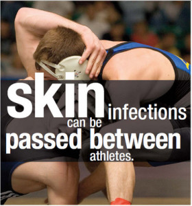 mrsa-skin-infect-between-athletes